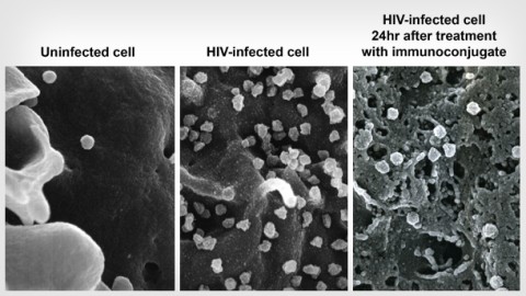 Curing HIV: Depleting Memory Cells To Eliminate Latent HIV